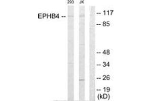 Western Blotting (WB) image for anti-EPH Receptor B4 (EPHB4) (AA 571-620) antibody (ABIN2889520) (EPH Receptor B4 anticorps  (AA 571-620))