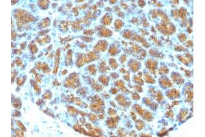 Formalin-fixed, paraffin-embedded human Pancreas stained with Milk Fat Globule Monoclonal Antibody (MFG-06)
