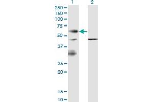 Western Blot analysis of EPOR expression in transfected 293T cell line by EPOR monoclonal antibody (M02), clone 3F6. (EPOR anticorps  (AA 31-130))