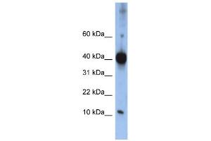 WB Suggested Anti-LSM4 Antibody Titration:  0. (LSM4 anticorps  (Middle Region))