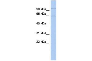 WB Suggested Anti-INSM2 Antibody Titration: 0. (INSM2 anticorps  (Middle Region))