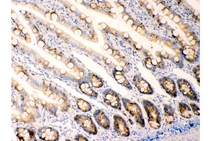 Anterior Gradient 2 was detected in paraffin-embedded sections of  rat intestine tissues using rabbit anti- Anterior Gradient 2 Antigen Affinity purified polyclonal antibody (Catalog # ) at 1 µg/mL.