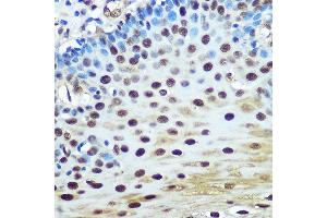 Immunohistochemistry of paraffin-embedded human esophageal using hnRNP K Rabbit mAb (ABIN7267634) at dilution of 1:100 (40x lens). (HNRNPK anticorps)