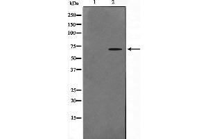 Western blot analysis on A549 cell lysate using CERKL Antibody,The lane on the left is treated with the antigen-specific peptide. (CERKL anticorps  (Internal Region))