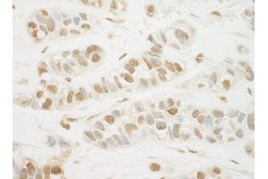 anti-Mediator Complex Subunit 13-Like (MED13L) (AA 550-600) antibody
