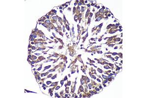 Immunohistochemistry of paraffin-embedded Rat testis using  Rabbit pAb (ABIN7265603) at dilution of 1:100 (40x lens). (ANKLE2 anticorps  (AA 350-450))