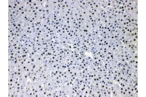 IHC testing of FFPE rat liver tissue with HDGF antibody at 1ug/ml. (HDGF anticorps  (AA 61-97))