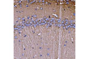 IHC analysis of SH3GL2 using anti-SH3GL2 antibody (ABIN7602229). (SH3G2 anticorps  (AA 65-292))