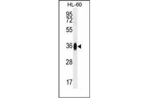Western blot analysis of GGH Antibody (N-term) in HL-60 cell line lysates (35ug/lane). (GGH anticorps  (N-Term))