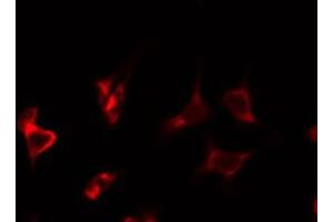 ABIN6274874 staining COLO205 by IF/ICC.