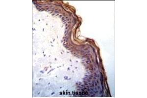 Kallikrein 7(KLK7) Antibody (C-term) (ABIN652198 and ABIN2840744) immunohistochemistry analysis in formalin fixed and paraffin embedded human skin tissue followed by peroxidase conjugation of the secondary antibody and DAB staining. (Kallikrein 7 anticorps  (C-Term))