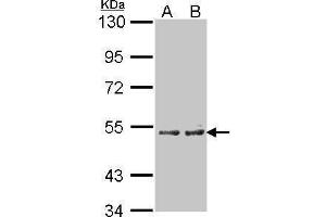 WB Image Sample(30 μg of whole cell lysate) A:A431, B:H1299 7.