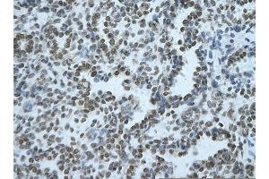 Rabbit Anti-BHLHE40 Antibody       Paraffin Embedded Tissue:  Human alveolar cell   Cellular Data:  Epithelial cells of renal tubule  Antibody Concentration:   4. (BHLHE40 anticorps  (Middle Region))