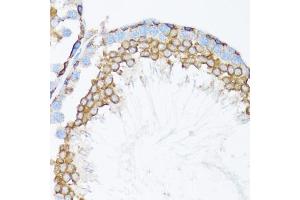 Immunohistochemistry of paraffin-embedded mouse testis using CTNNA1 antibody. (CTNNA1 anticorps)