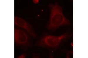 Immunofluorescence staining of methanol-fixed Hela cells using NFkB-p105(Phospho-Ser927) Antibody. (NFKB1 anticorps  (pSer927))