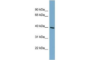 WB Suggested Anti-ST8SIA6 Antibody Titration:  0. (ST8SIA6 anticorps  (Middle Region))