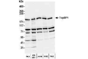 anti-Topoisomerase (DNA) II Binding Protein 1 (TOPBP1) (C-Term) antibody