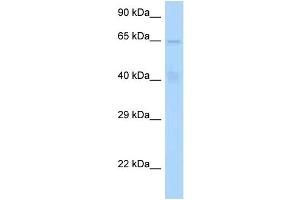 WB Suggested Anti-STAM Antibody Titration: 1. (STAM anticorps  (N-Term))