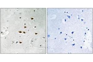 Immunohistochemistry analysis of paraffin-embedded human brain, using ITCH (Phospho-Tyr420) Antibody. (ITCH anticorps  (pTyr420))