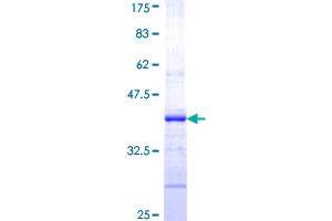 Image no. 1 for Cystic Fibrosis Transmembrane Conductance Regulator (ATP-Binding Cassette Sub-Family C, Member 7) (CFTR) (AA 1381-1480) protein (GST tag) (ABIN1349232)