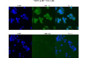Sample Type :  HCT116   Primary Antibody Dilution:  4 ug/ml   Secondary Antibody :  Anti-rabbit Alexa 546   Secondary Antibody Dilution:  2 ug/ml   Gene Name :  TFDP1 (DP1 anticorps  (N-Term))