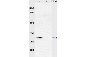Lane 1: mouse liver lysates Lane 2: mouse intestine lysates probed with Anti AHSG/Fetuin A/Alpha 2 HS Glycoprotein Polyclonal Antibody, Unconjugated (ABIN681733) at 1:200 in 4 °C.