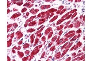 EAP30 antibody was used for immunohistochemistry at a concentration of 4-8 ug/ml. (SNF8 anticorps  (N-Term))