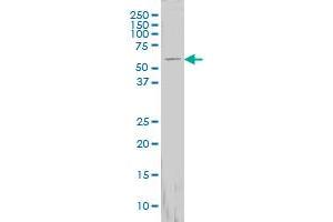 FTCD monoclonal antibody (M01), clone 3A4 Western Blot analysis of FTCD expression in HepG2 .