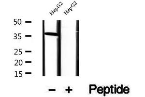 Western blot analysis of extracts of HepG2 cells, using RLBP1 antibody.