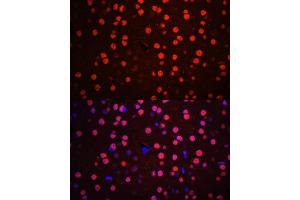 Immunofluorescence analysis of mouse brain using Phospho-p38 MAPK-T180/Y182 antibody (ABIN6135257, ABIN6136138, ABIN6136139 and ABIN6225556) at dilution of 1:100. (MAPK14 anticorps  (pThr180, pTyr182))
