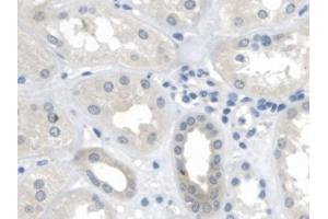 Detection of MTUS1 in Human Kidney Tissue using Polyclonal Antibody to Mitochondrial Tumor Suppressor 1 (MTUS1) (MTUS1 anticorps  (AA 1018-1270))