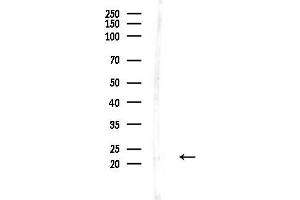 anti-Dihydrofolate Reductase (DHFR) antibody