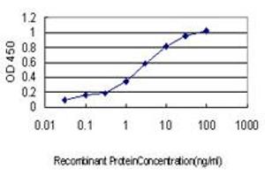 Detection limit for recombinant GST tagged CDKL5 is approximately 0. (CDKL5 anticorps  (AA 722-831))