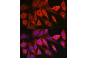 anti-Hepatitis B Virus X-Interacting Protein (HBXIP) (AA 1-173) antibody