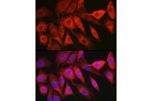 Immunofluorescence analysis of NIH/3T3 cells using L Rabbit pAb (ABIN6130466, ABIN6143085, ABIN6143086 and ABIN6219719) at dilution of 1:200 (40x lens). (HBXIP anticorps  (AA 1-173))