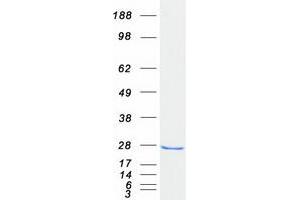 Validation with Western Blot