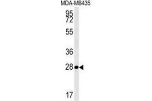 Western blot analysis in MDA-MB435 cell line lysates (35ug/lane) using MRM1 Antibody (N-term).