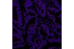 Immunofluorescent analysis of paraformaldehyde-fixed human colon cancer using Ring1A (ABIN7075467) at dilution of 1: 800