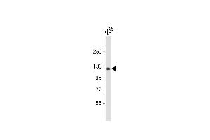 Anti-COL1A2 Antibody (N-term) at 1:1000 dilution + 293 whole cell lysate Lysates/proteins at 20 μg per lane.