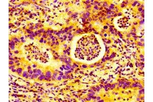 anti-Autocrine Motility Factor Receptor (AMFR) (AA 485-643) antibody