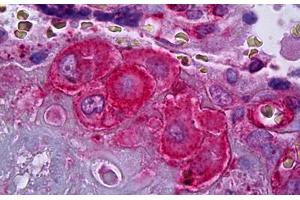 Anti-SERPINE1 / PAI-1 antibody IHC staining of human placenta, decidual cells. (PAI1 anticorps)