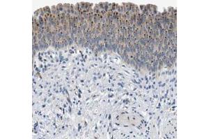 Immunohistochemical staining (Formalin-fixed paraffin-embedded sections) of human urinary bladder with EMR3 polyclonal antibody  shows dot like cytoplasmic positivity in urothelial cells at 1:50-1:200 dilution.