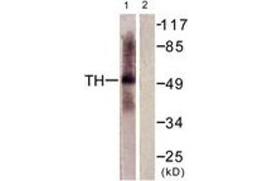 Western blot analysis of extracts from HepG2 cells, using Tryptophan Hydroxylase (Ab-58) Antibody.