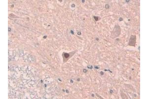 Detection of IL18 in Rat Spinal cord Tissue using Polyclonal Antibody to Interleukin 18 (IL18)