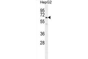 Western Blotting (WB) image for anti-Ubiquitin Family Domain Containing 1 (UBFD1) antibody (ABIN2996005) (UBFD1 anticorps)
