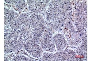 Immunohistochemistry (IHC) analysis of paraffin-embedded Human Lung, antibody was diluted at 1:100.