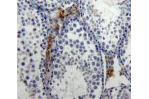 Used in DAB staining on fromalin fixed paraffin-embedded Testis tissue (IL-21 anticorps  (AA 25-146))
