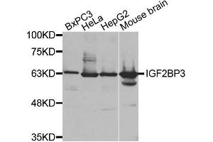 Western Blotting (WB) image for anti-Insulin-Like Growth Factor 2 mRNA Binding Protein 3 (IGF2BP3) antibody (ABIN1873168) (IGF2BP3 anticorps)
