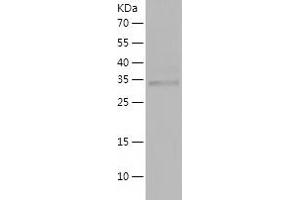 Western Blotting (WB) image for KRIT1, Ankyrin Repeat Containing (KRIT1) (AA 203-529) protein (His tag) (ABIN7123697)