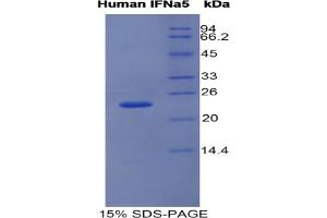 SDS-PAGE analysis of Human Interferon alpha 5 Protein.